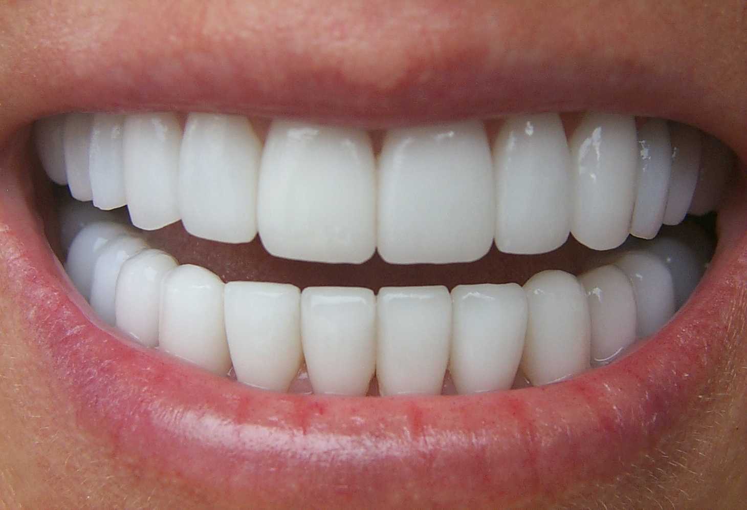 Стоматолог — о главном. Почему необходимо заботиться о зубах?