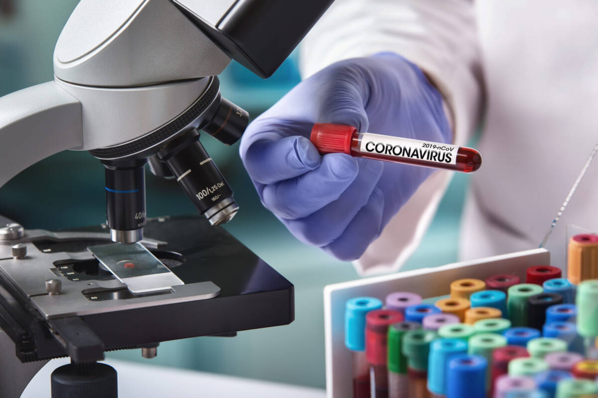 Более 76 тыс. тестов на коронавирус проведено в Беларуси