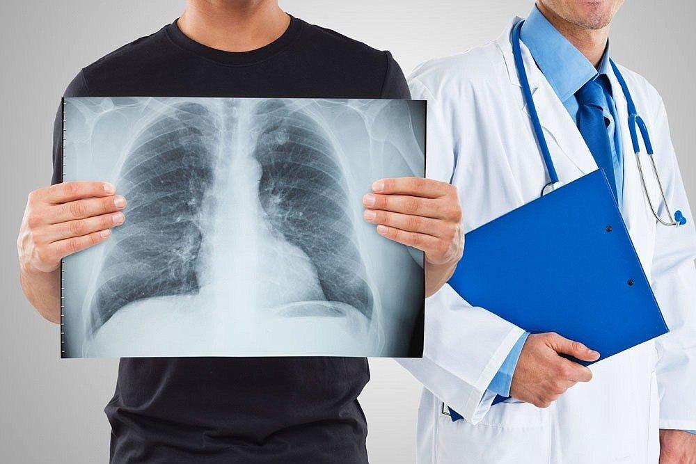 Зачем ежегодно проходить флюорографию и как обезопасить себя от туберкулеза?