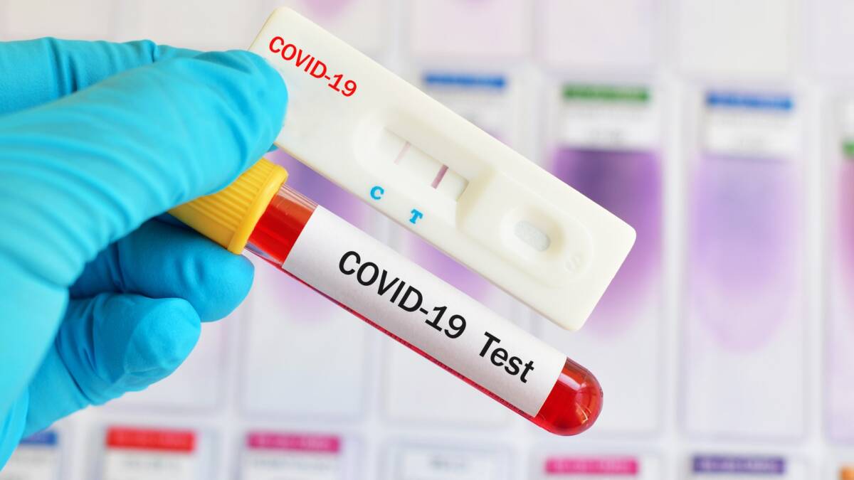 Белорусские ученые разработают комбинированный экспресс-тест для определения коронавируса и гриппа